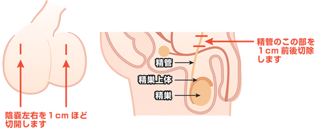 カット 後悔 パイプ