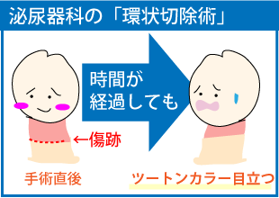 泌尿器科　治し方